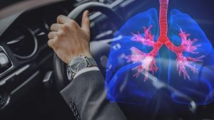 questa-dimenticanza-in-auto-e-letale-ti-danneggia-i-polmoni-controlla-subito